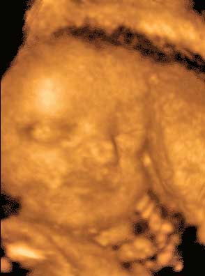 3d ultrasound pictures