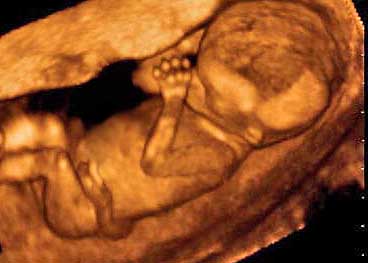 4d ultrasounds