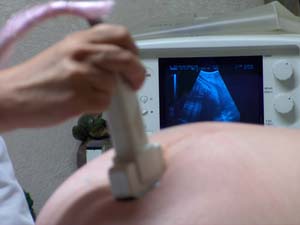 ultrasound technology